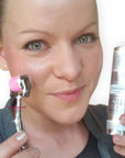 amepure, dermaroller, âme pure resultater, fjerne pigmentflekker, før og etter, microneedling, skin roller, dermapen, mesoterapi, âmepure