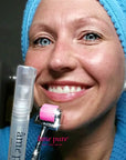 amepure, dermaroller, âme pure resultater, fjerne pigmentflekker, før og etter, microneedling, skin roller, dermapen, mesoterapi, âmepure