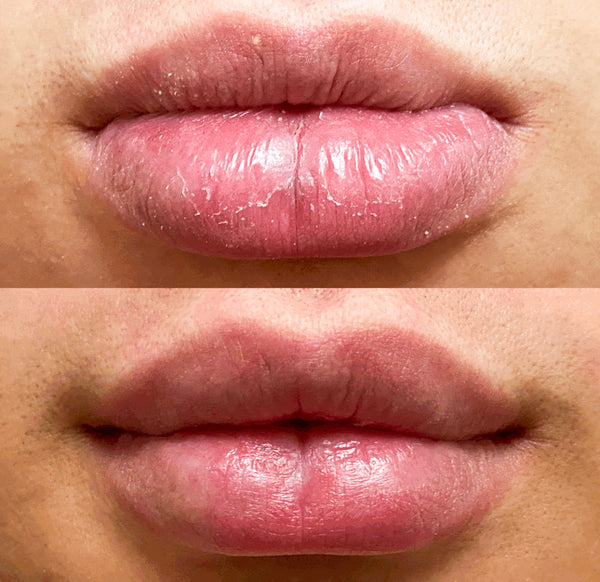before after lip balm amepure,tørre lepper, dry lips, leppemaske, lip mask.jpg